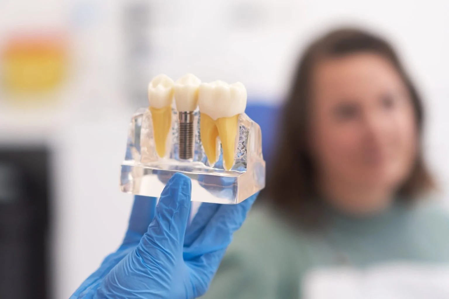 What to Expect After Getting Dental Implants