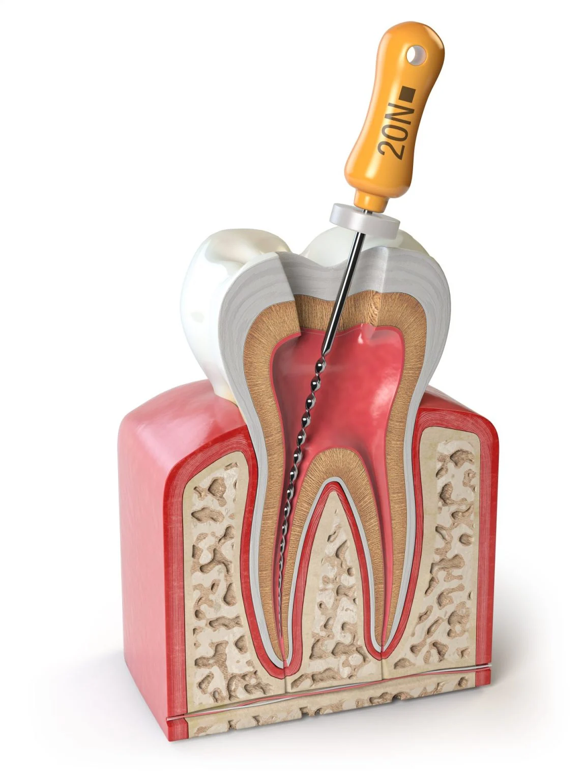 Signs You Might Need a Root Canal in High Point, NC