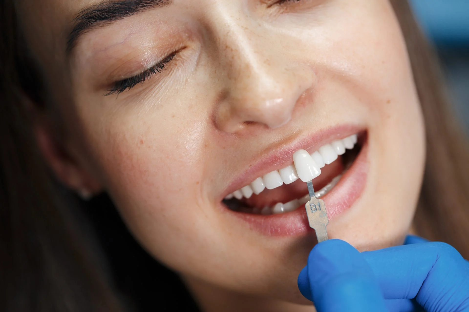 dentist white teeth 2