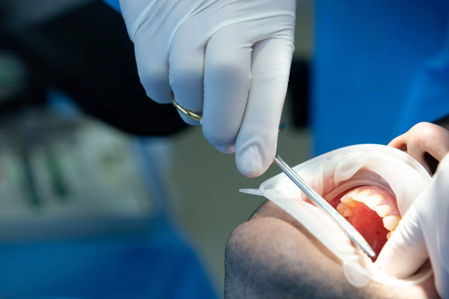 dentist with tool makes some manipulations patient s mouth 1