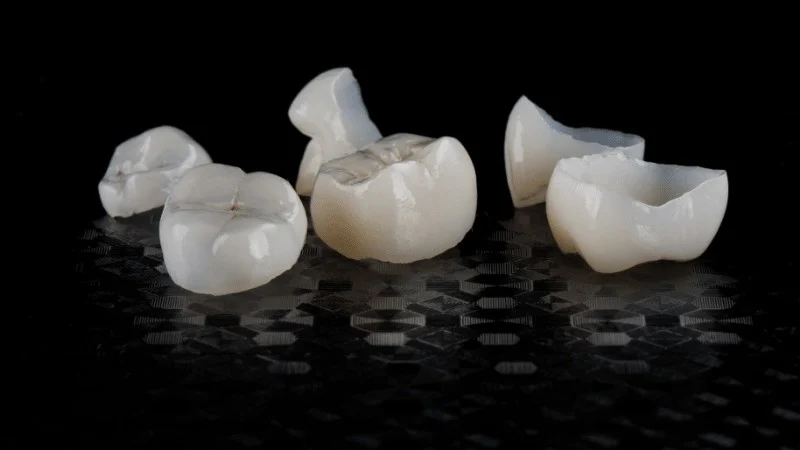 how long do dental crowns last