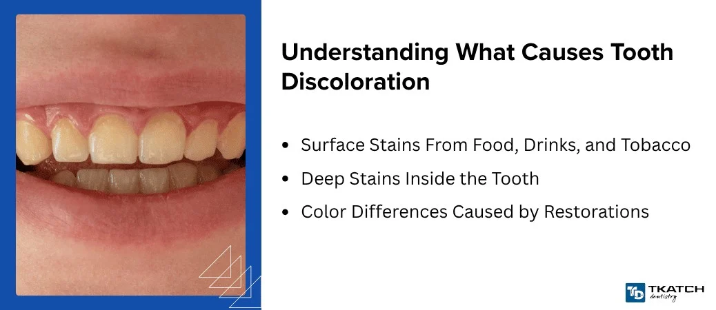 Identify Why Your Teeth Are Discolored