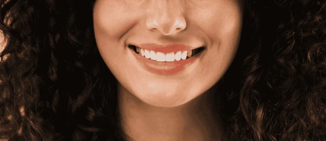 cost of dental veneers