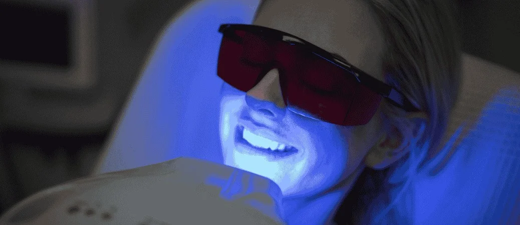 teeth whitening not working