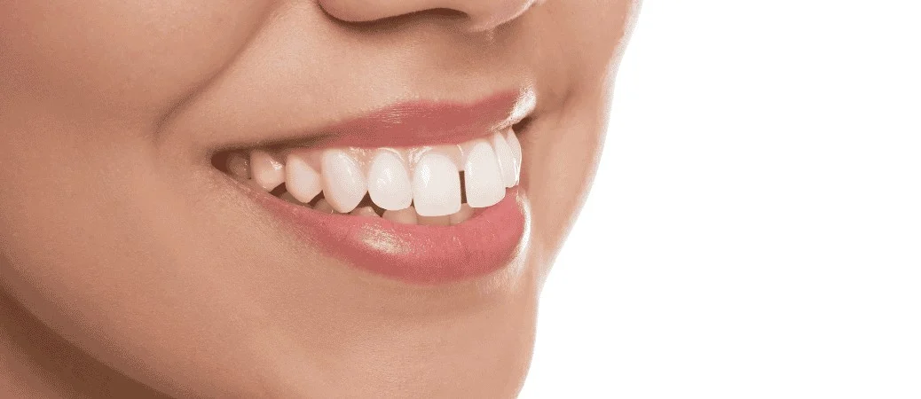 effects of a bad bite on teeth